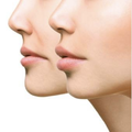 Face Yoga