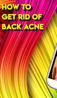 HOW TO GET RID OF BACK ACNE 포스터