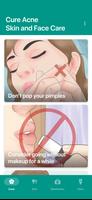 Cure Acne – Skin and Face Care poster
