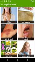 Gharelu Upchar Hindi- आयुर्वेदिक उपचार Affiche